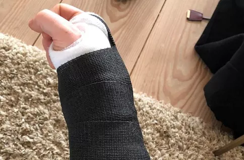 Ställer in en rad konserter efter cykelolycka