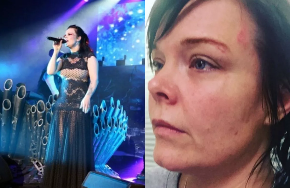 Svensk rockstjärna slogs ned och rånades