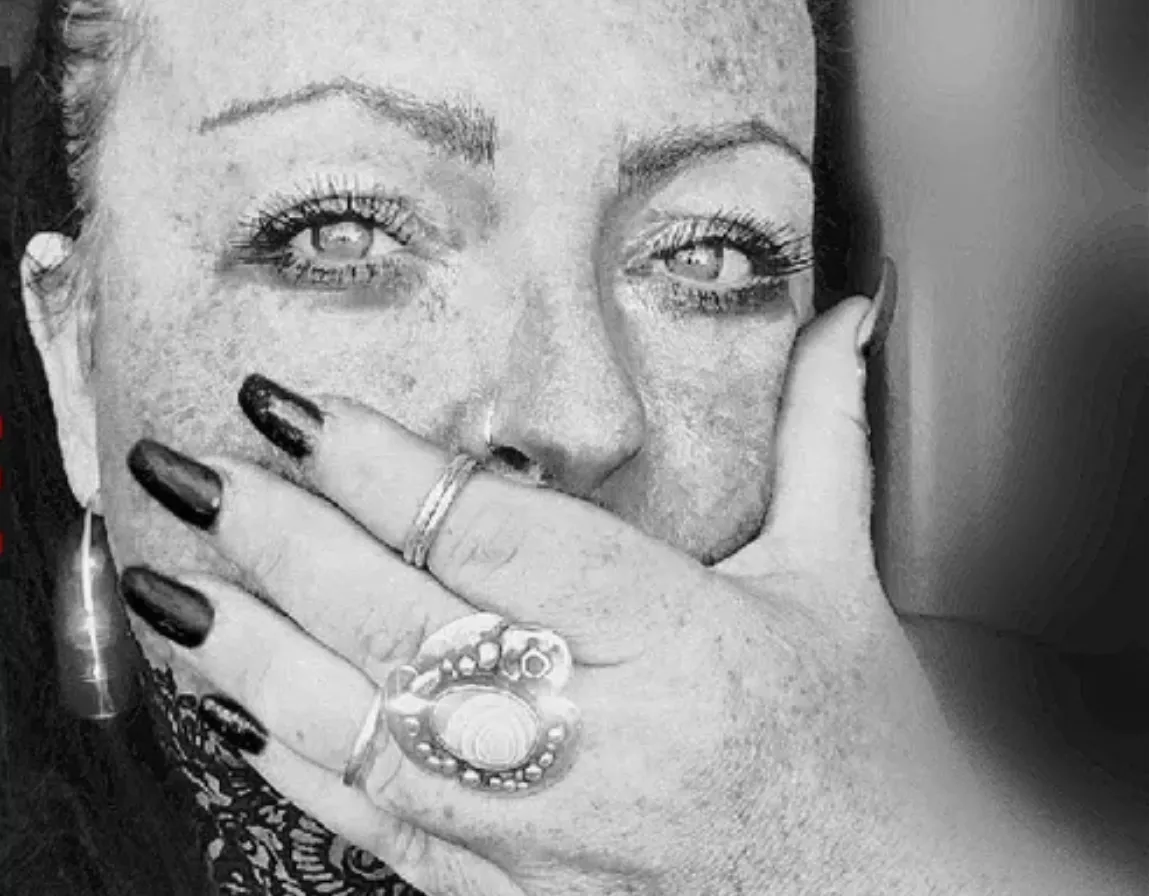 Efter käkbensdöden – E-Types sångerska vädjar om hjälp