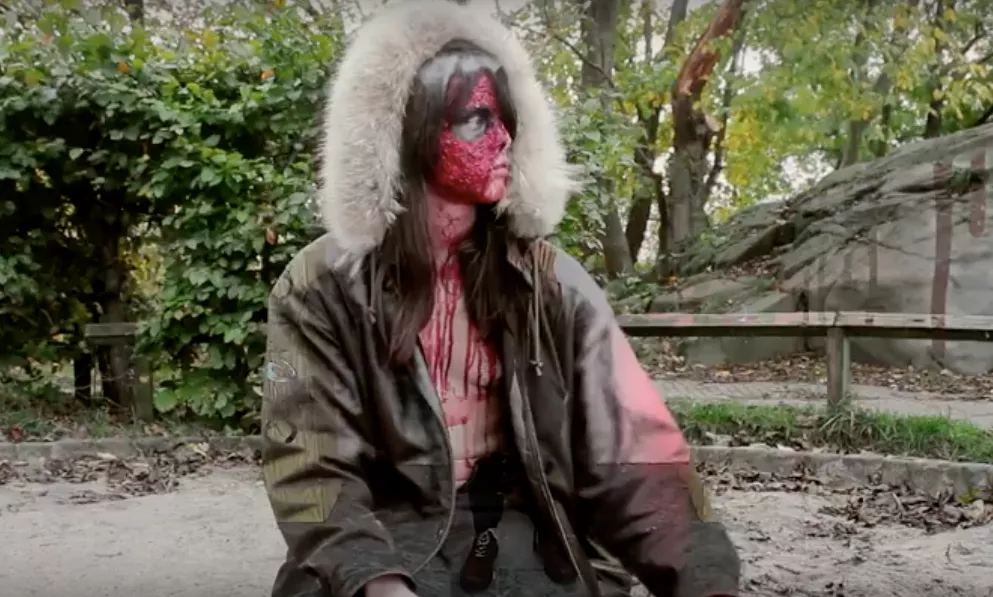 ShitKid, bloody ShitKid