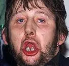 Shane McGowan enden nær