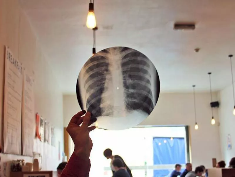 Ryssar spred förbjuden rockmusik med röntgenbilder