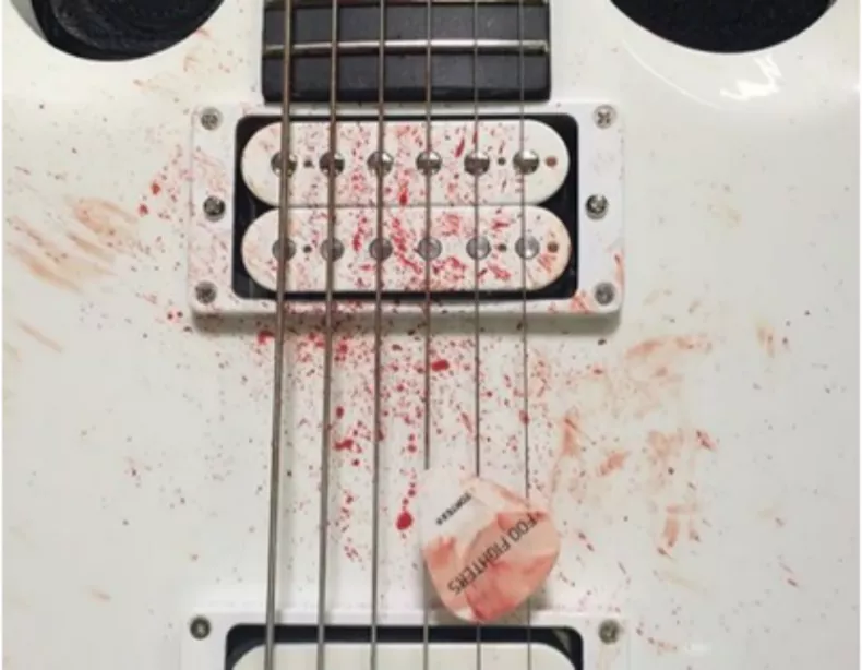 Blodstänkta livstecken från Foo Fighters
