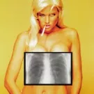 Bands støtter brysterne